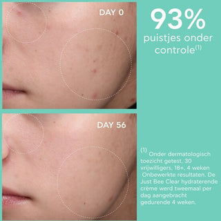 Just Bee Clear Blemish Control Mattifying Moisturizer Apivita