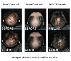 Haargroei Serum Macrovita