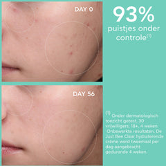 Just Bee Clear Blemish Control Mattifying Moisturizer Apivita