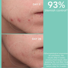 Just Bee Clear Blemish Control Mattifying Moisturizer Apivita